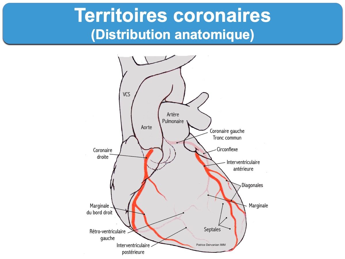 Territoire électrique coronaire : e-cardiogram