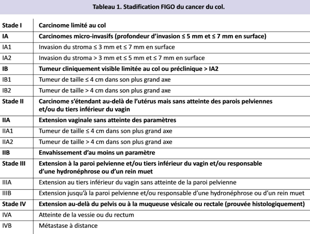 JIM.fr - Bilan d'extension du cancer du col : quelle valeur accorder aux  outils actuels ?